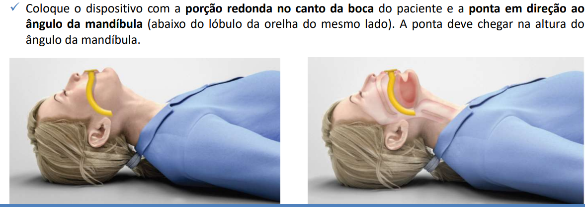 Pasted image 20241215122310.png
