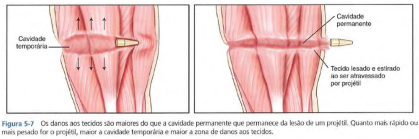 Mechanisms of injury