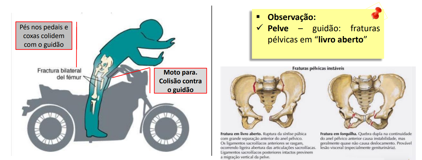 Frontal impact on motorcycle